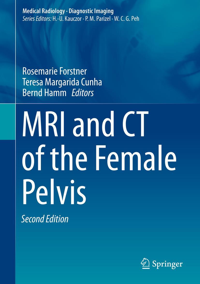 Cover: 9783319425733 | MRI and CT of the Female Pelvis | Bernd Hamm (u. a.) | Buch | ix