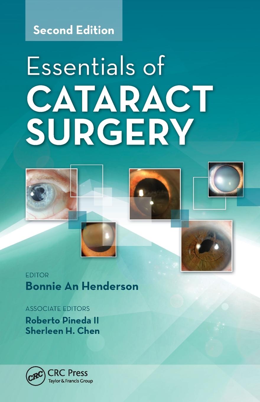 Cover: 9781617110672 | Essentials of Cataract Surgery | Bonnie Henderson | Taschenbuch | 2014