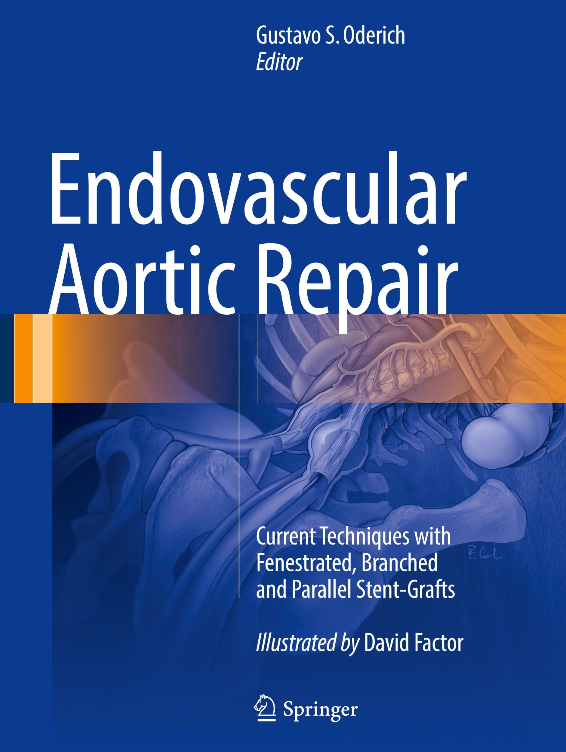 Cover: 9783319151915 | Endovascular Aortic Repair | Gustavo S. Oderich | Buch | xxvi | 2017