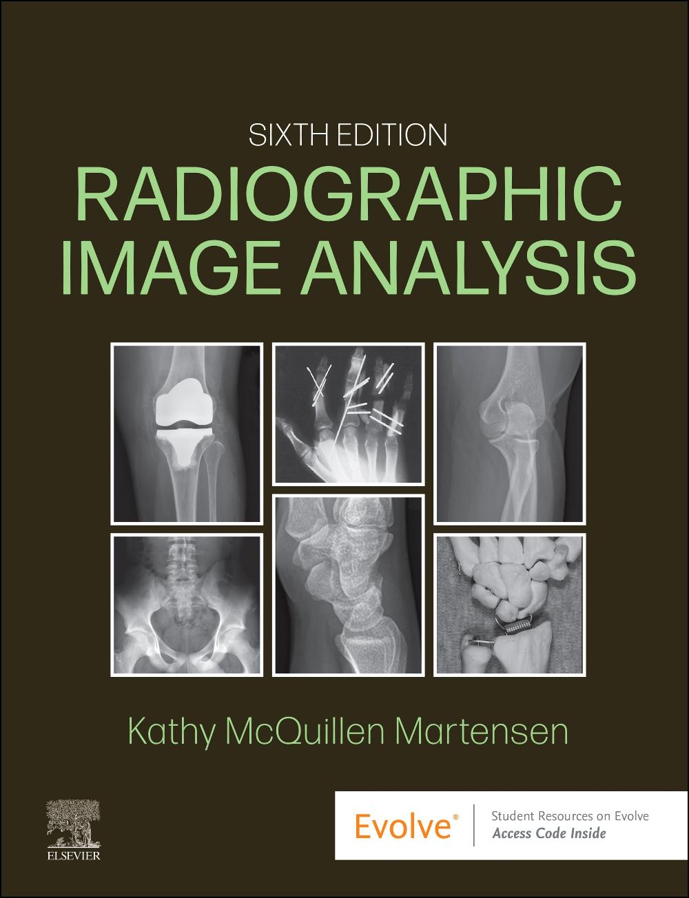 Cover: 9780323930697 | Radiographic Image Analysis | Kathy McQuillen Martensen | Buch | 2024