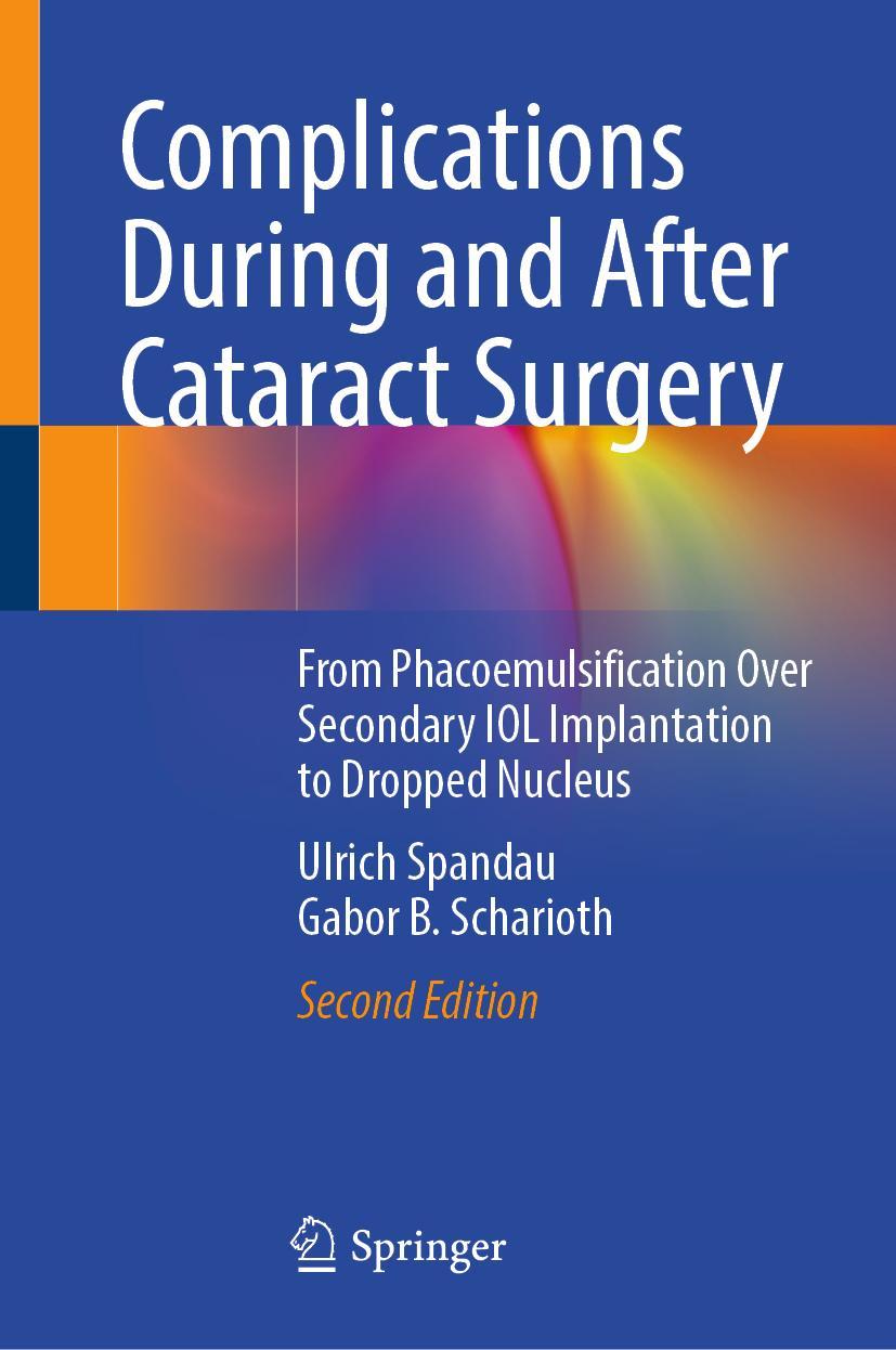 Cover: 9783030935306 | Complications During and After Cataract Surgery | Scharioth (u. a.)