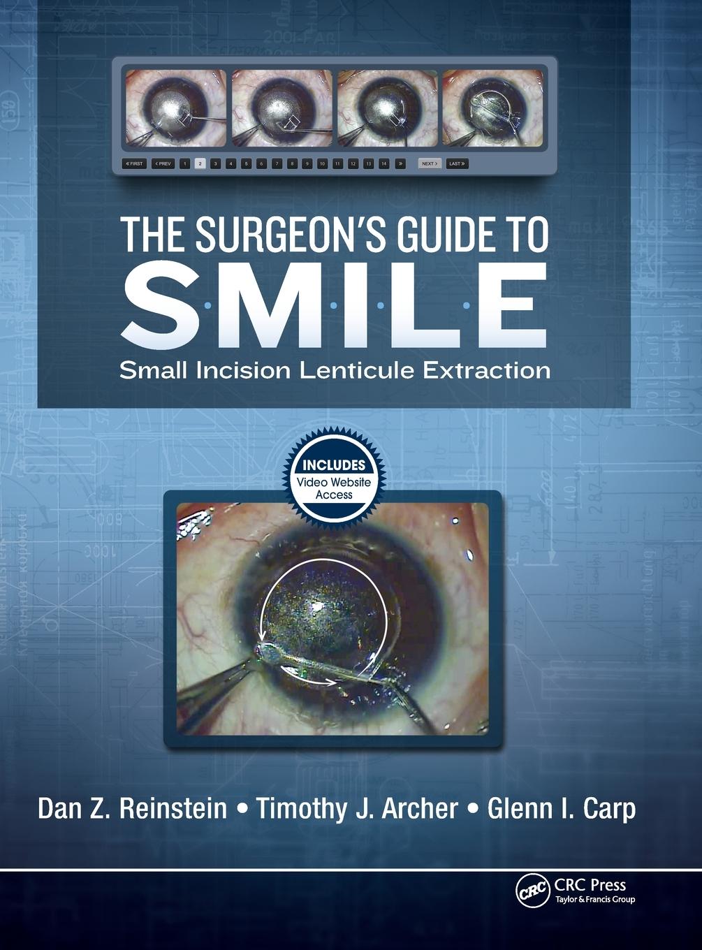 Cover: 9781630912659 | The Surgeon's Guide to SMILE | Small Incision Lenticule Extraction