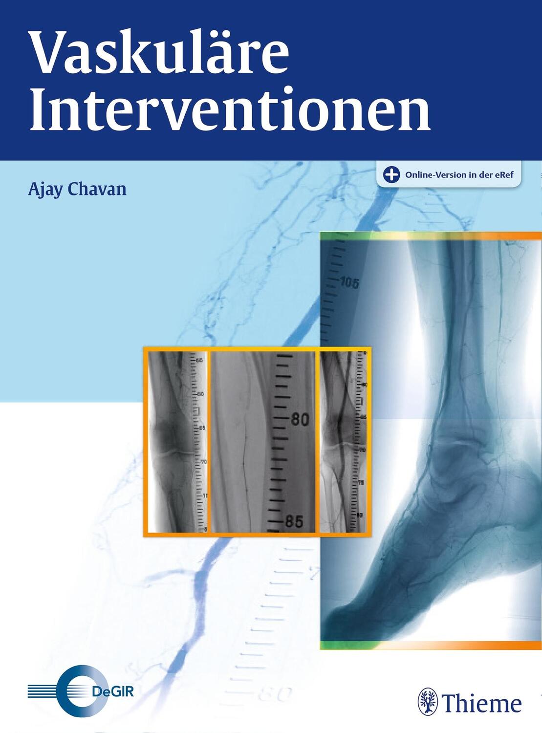 Cover: 9783131532015 | Vaskuläre Interventionen | Ajay Chavan | Bundle | Mixed media product