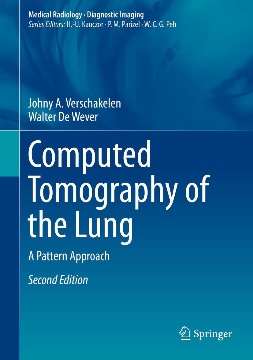 Cover: 9783642395178 | Computed Tomography of the Lung | A Pattern Approach | Wever (u. a.)