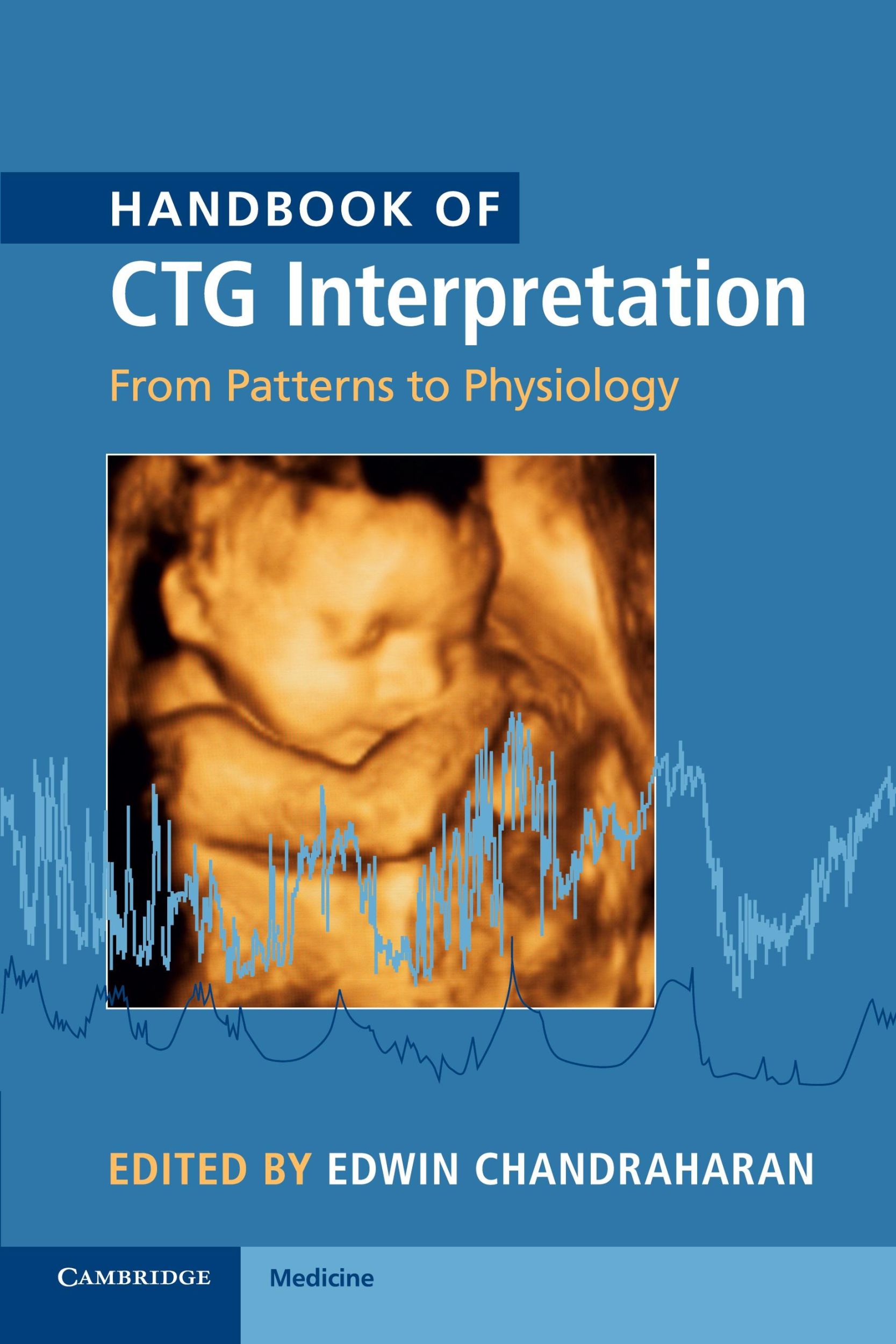 Cover: 9781107485501 | Handbook of CTG Interpretation | Edwin Chandraharan | Taschenbuch