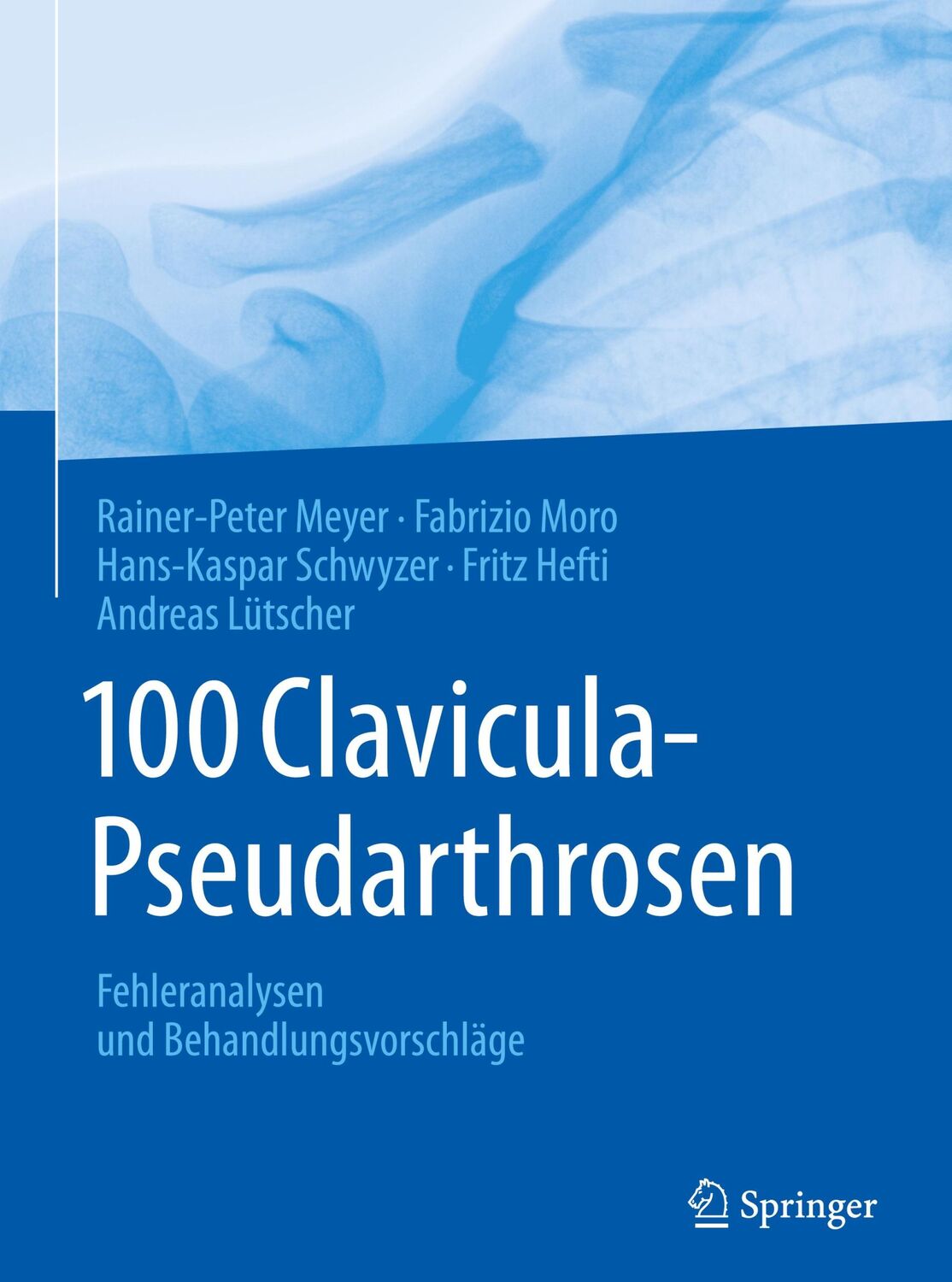 Cover: 9783662553442 | 100 Clavicula-Pseudarthrosen | Rainer-Peter Meyer (u. a.) | Buch | xix