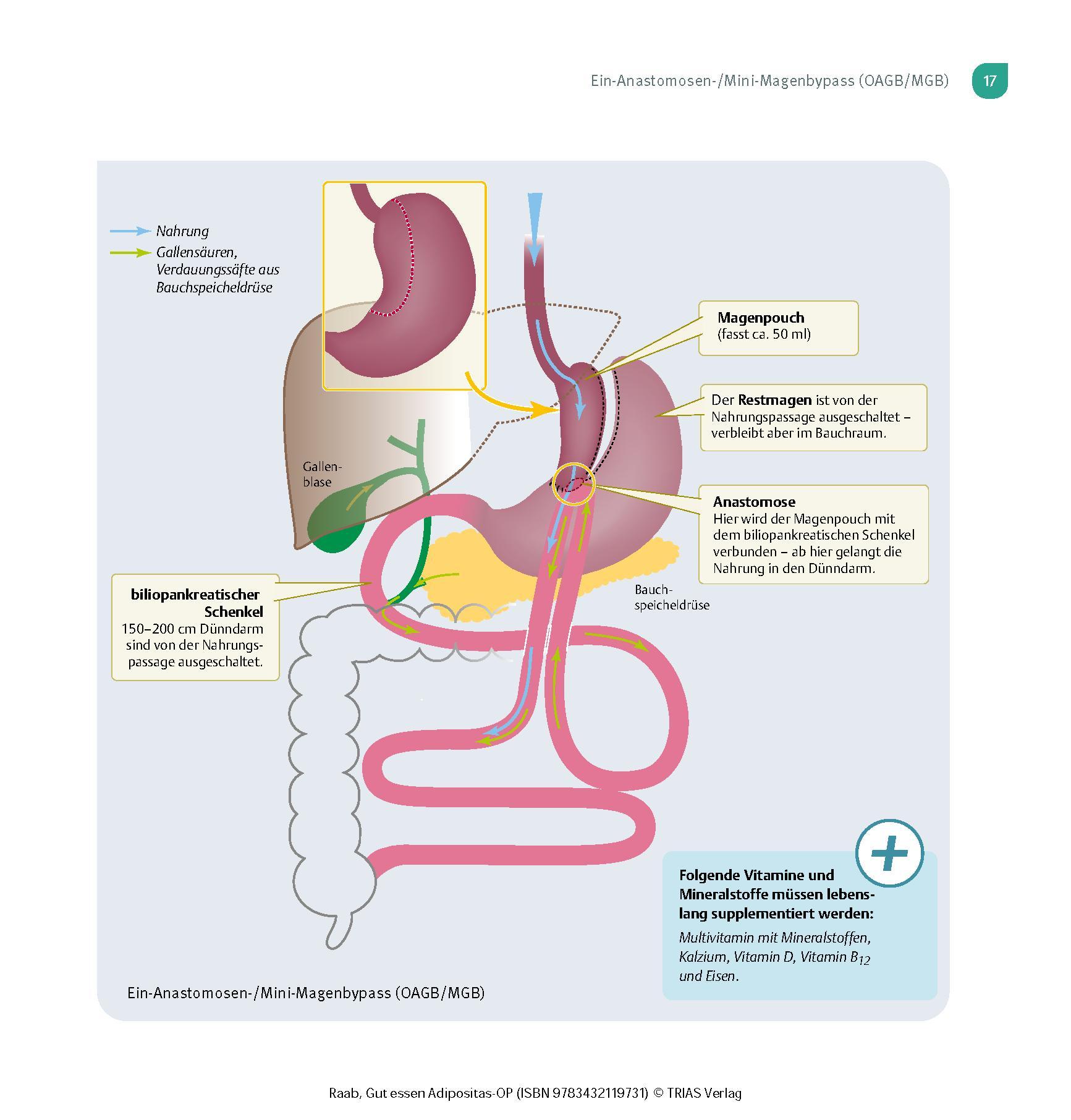 Bild: 9783432119731 | Gut essen Adipositas-OP | Heike Raab | Taschenbuch | Köstlich essen