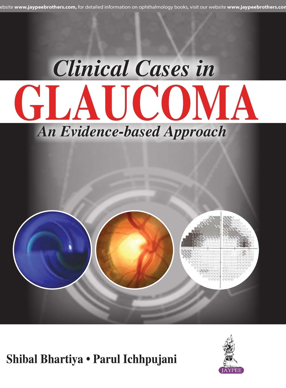 Cover: 9789386056962 | CLINICAL CASES IN GLAUCOMA AN EVIDENCE-BASED APPROACH | Bhartiya