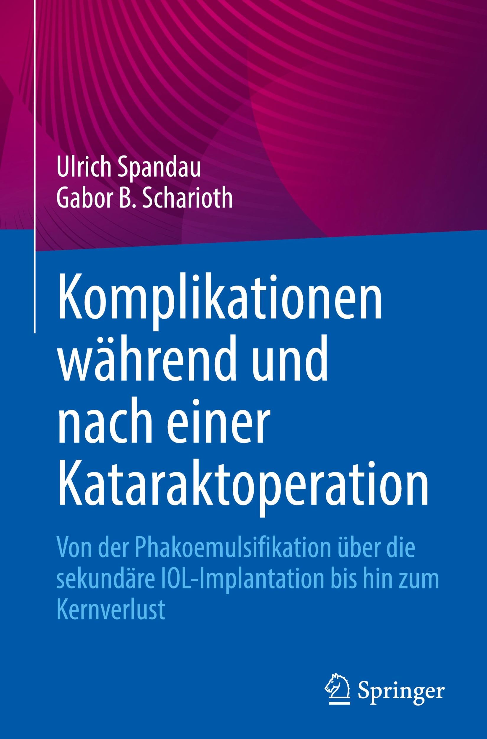 Cover: 9783031459832 | Komplikationen während und nach einer Kataraktoperation | Buch | xiii