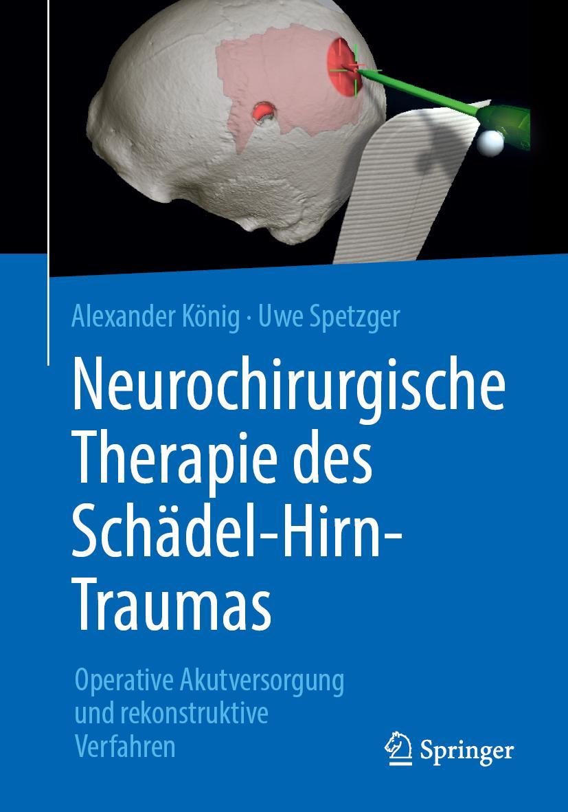 Cover: 9783662579275 | Neurochirurgische Therapie des Schädel-Hirn-Traumas | Spetzger (u. a.)