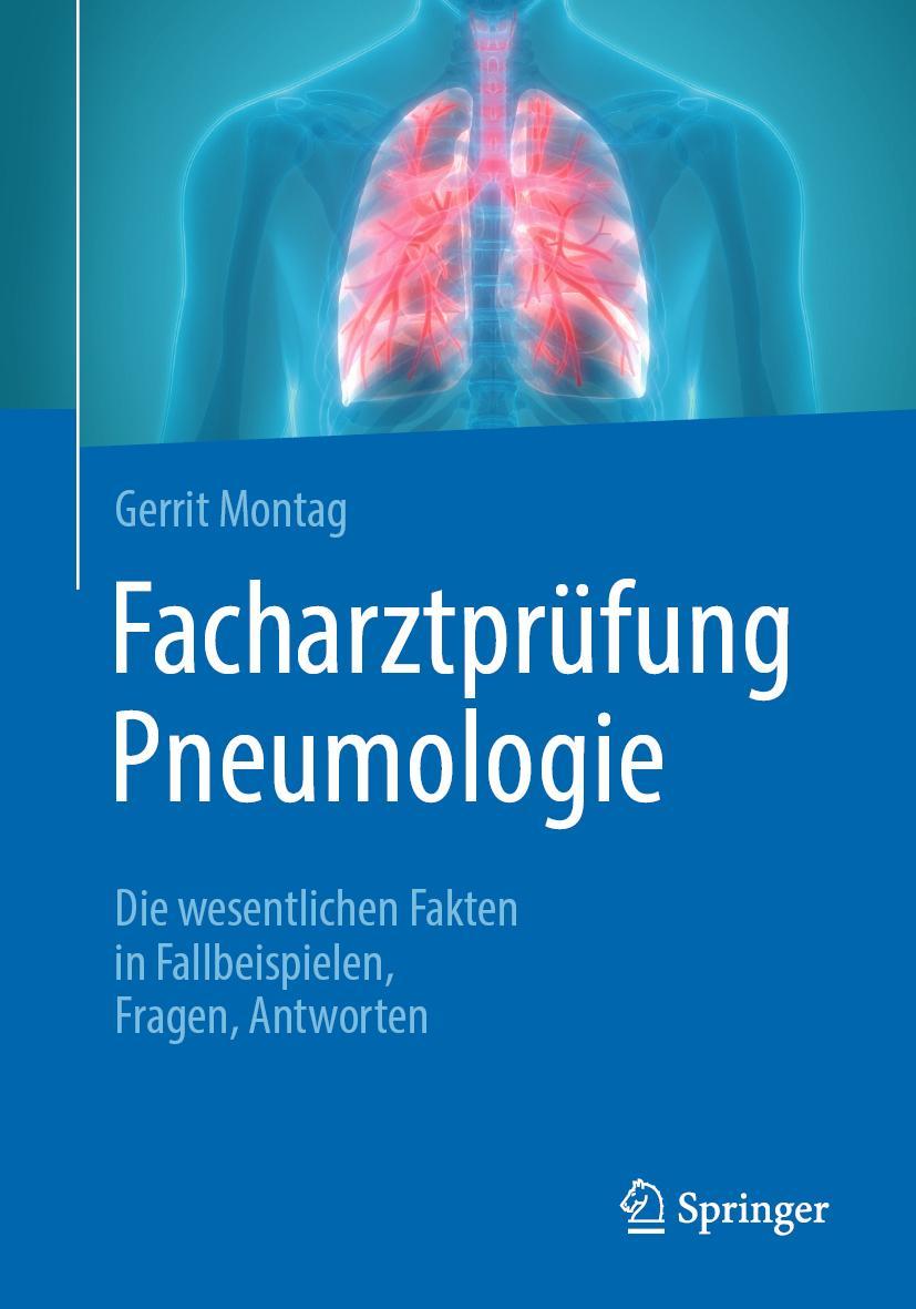 Cover: 9783662615737 | Facharztprüfung Pneumologie | Gerrit Montag | Taschenbuch | Deutsch