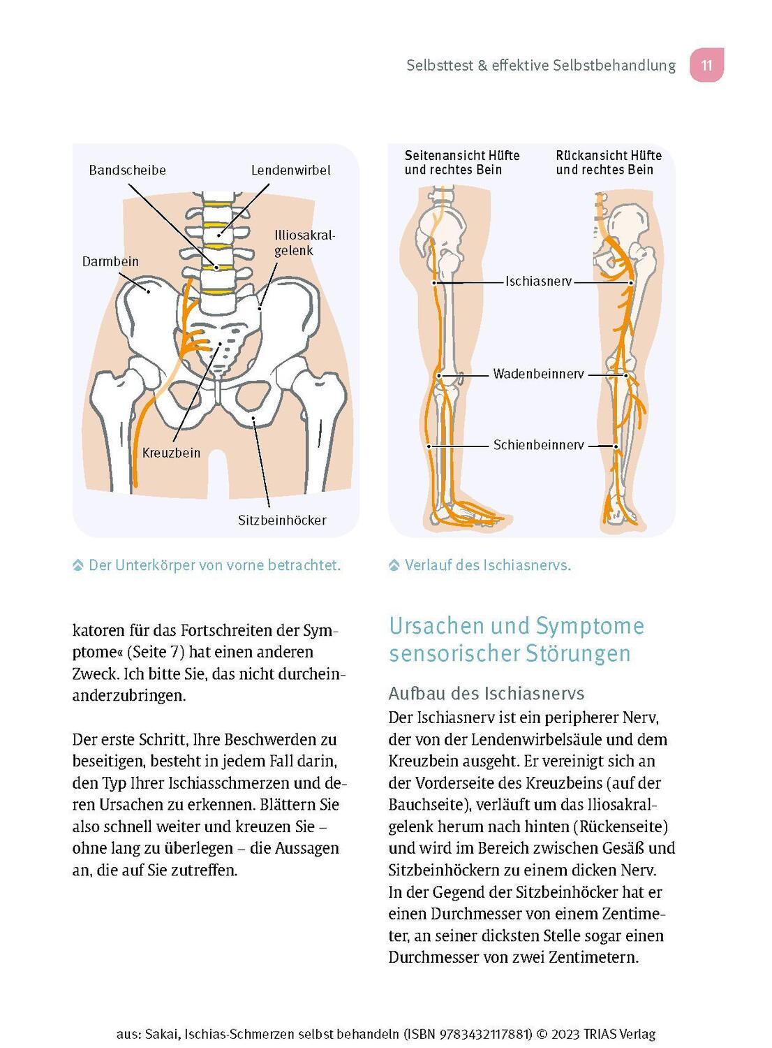 Bild: 9783432117881 | Ischias-Schmerzen selbst behandeln | Shintaro Sakai | Taschenbuch