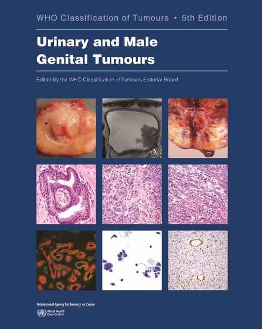 Cover: 9789283245124 | Urinary and Male Genital Tumours | Board | Taschenbuch | Englisch