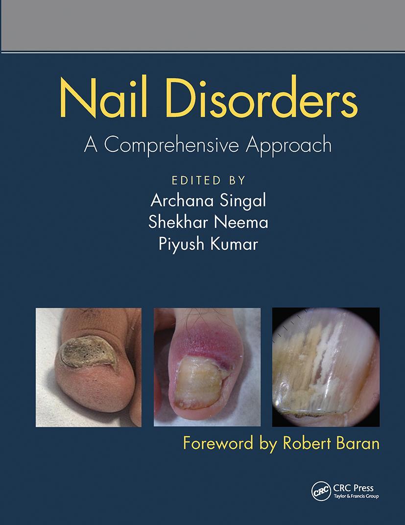 Cover: 9780367731717 | Nail Disorders | A Comprehensive Approach | Archana Singal (u. a.)