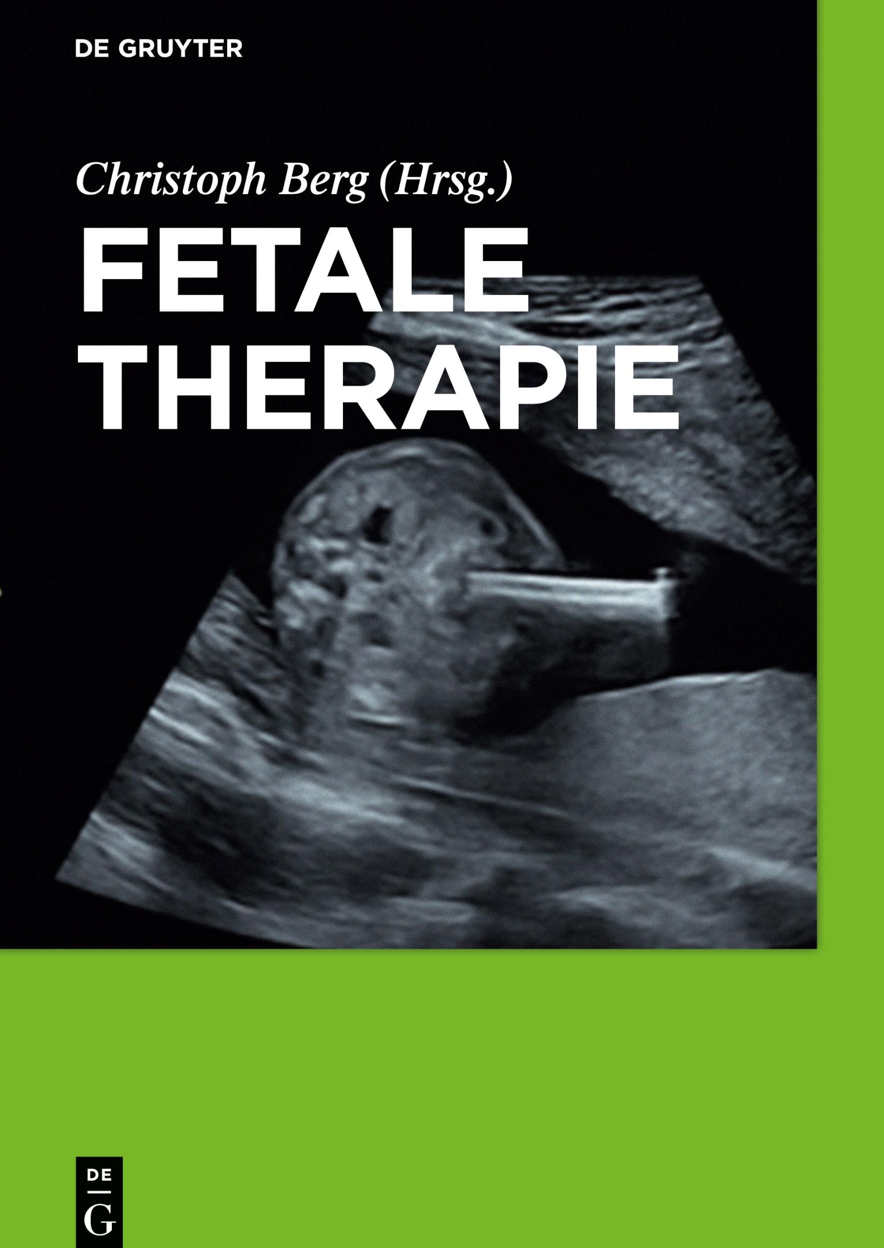 Cover: 9783110438413 | Fetale Therapie | Christoph Berg | Buch | XVIII | Deutsch | 2017