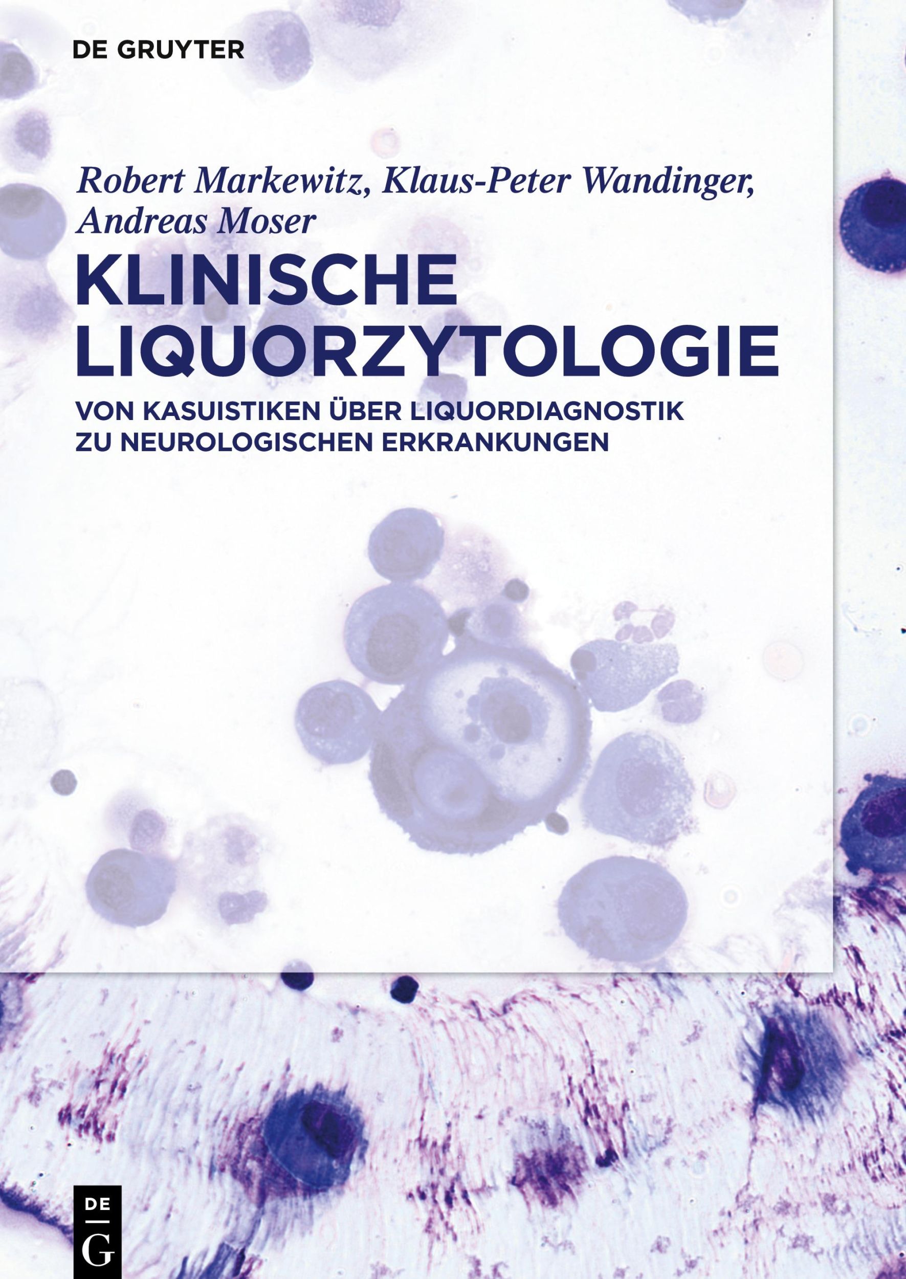 Cover: 9783110692815 | Klinische Liquorzytologie | Robert Markewitz (u. a.) | Buch | IX