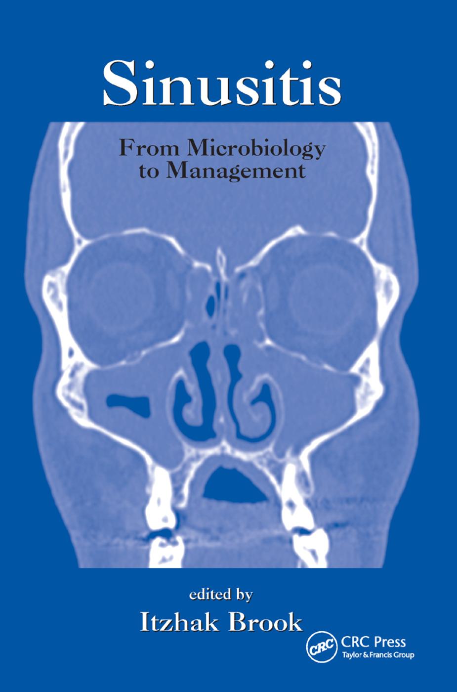 Cover: 9780367392154 | Sinusitis | From Microbiology To Management | Itzhak Brook | Buch