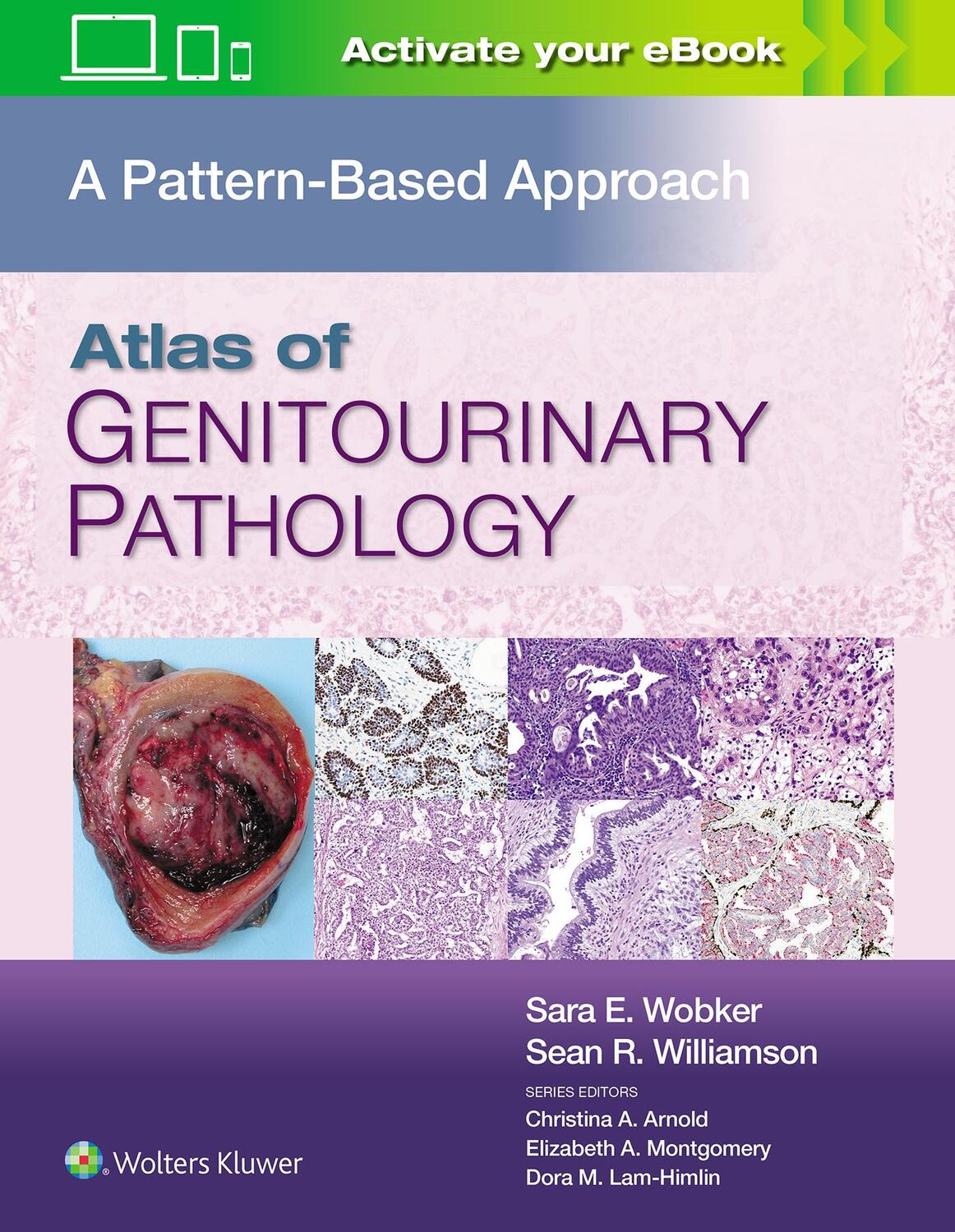 Cover: 9781496397669 | Atlas of Genitourinary Pathology | A Pattern Based Approach | Buch