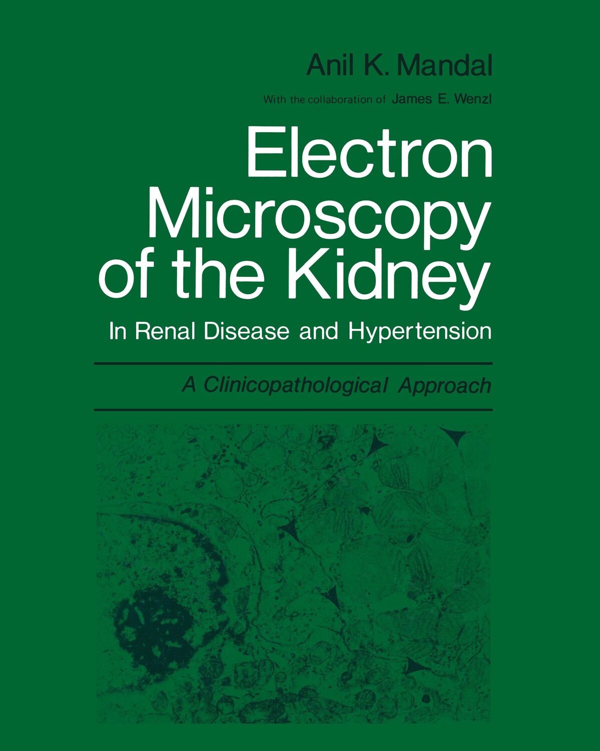 Cover: 9781475717013 | Electron Microscopy of the Kidney | Anil K. Mandal | Taschenbuch | xx