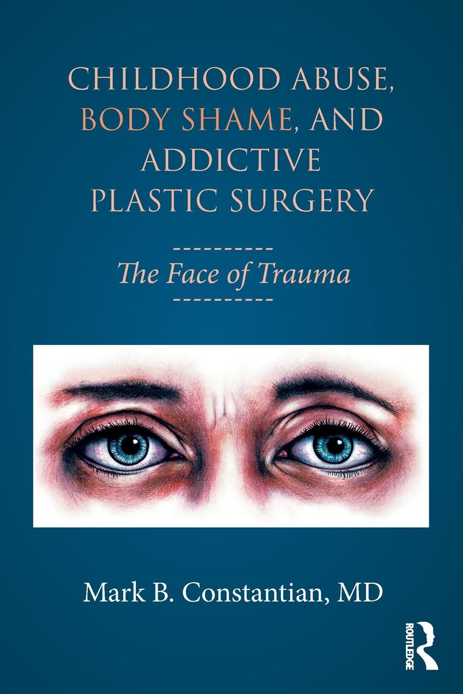 Cover: 9781138100312 | Childhood Abuse, Body Shame, and Addictive Plastic Surgery | Buch