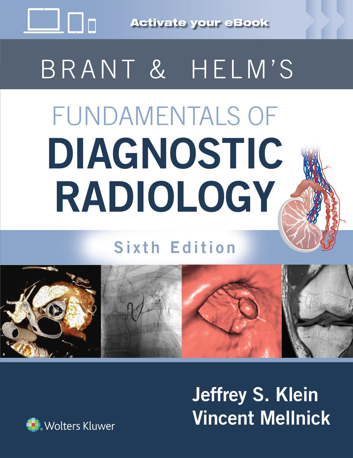 Cover: 9781975199005 | Brant &amp; Helms' Fundamentals of Diagnostic Radiology: Print + eBook...