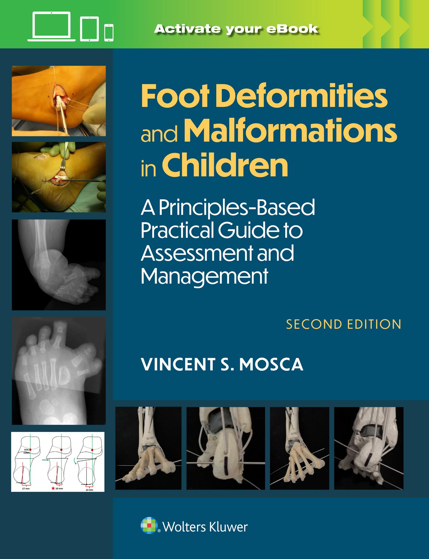 Cover: 9781975213374 | Foot Deformities and Malformations in Children | Vincent Mosca | Buch