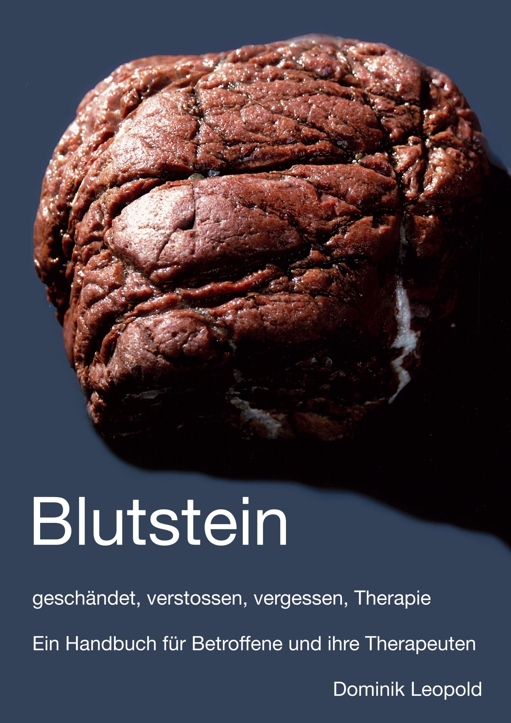 Cover: 9783741234019 | Blutstein - geschändet, verstossen, vergessen, Therapie | Leupold