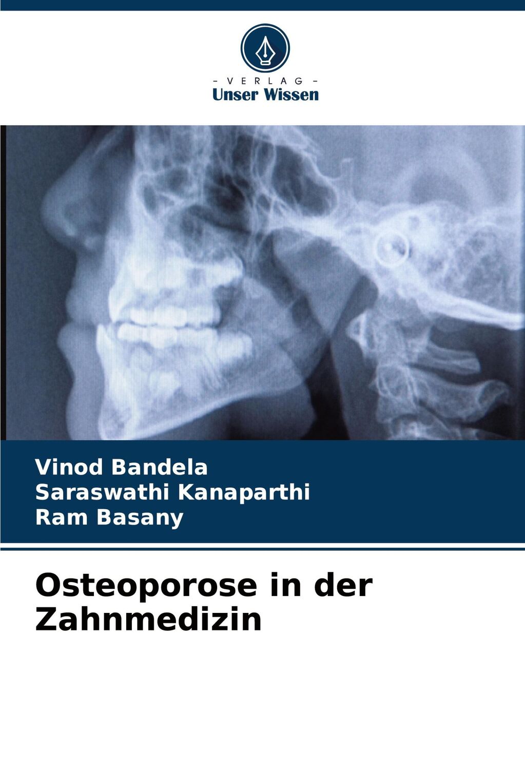 Cover: 9786208054694 | Osteoporose in der Zahnmedizin | Vinod Bandela (u. a.) | Taschenbuch