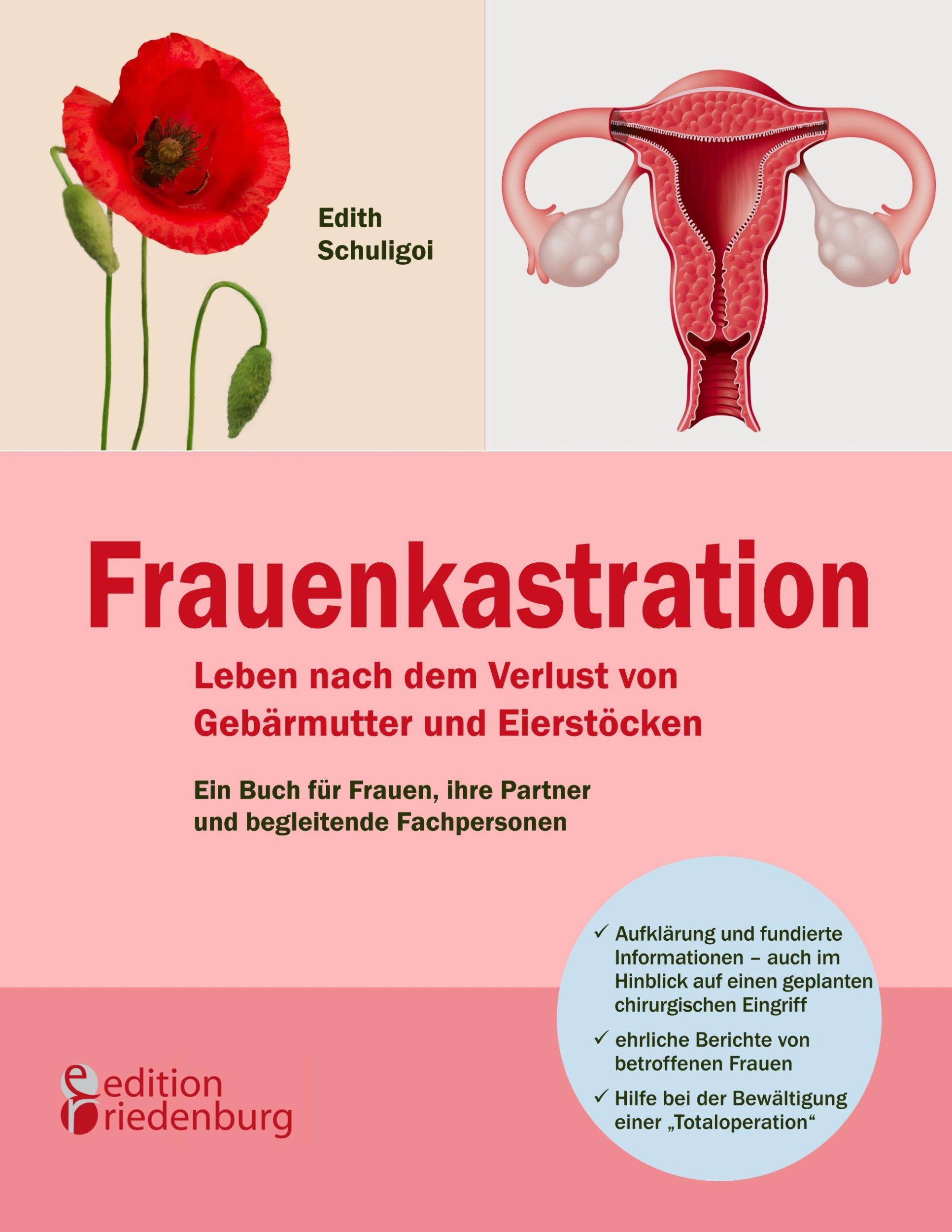 Cover: 9783902647313 | Frauenkastration - Leben nach dem Verlust von Gebärmutter und...