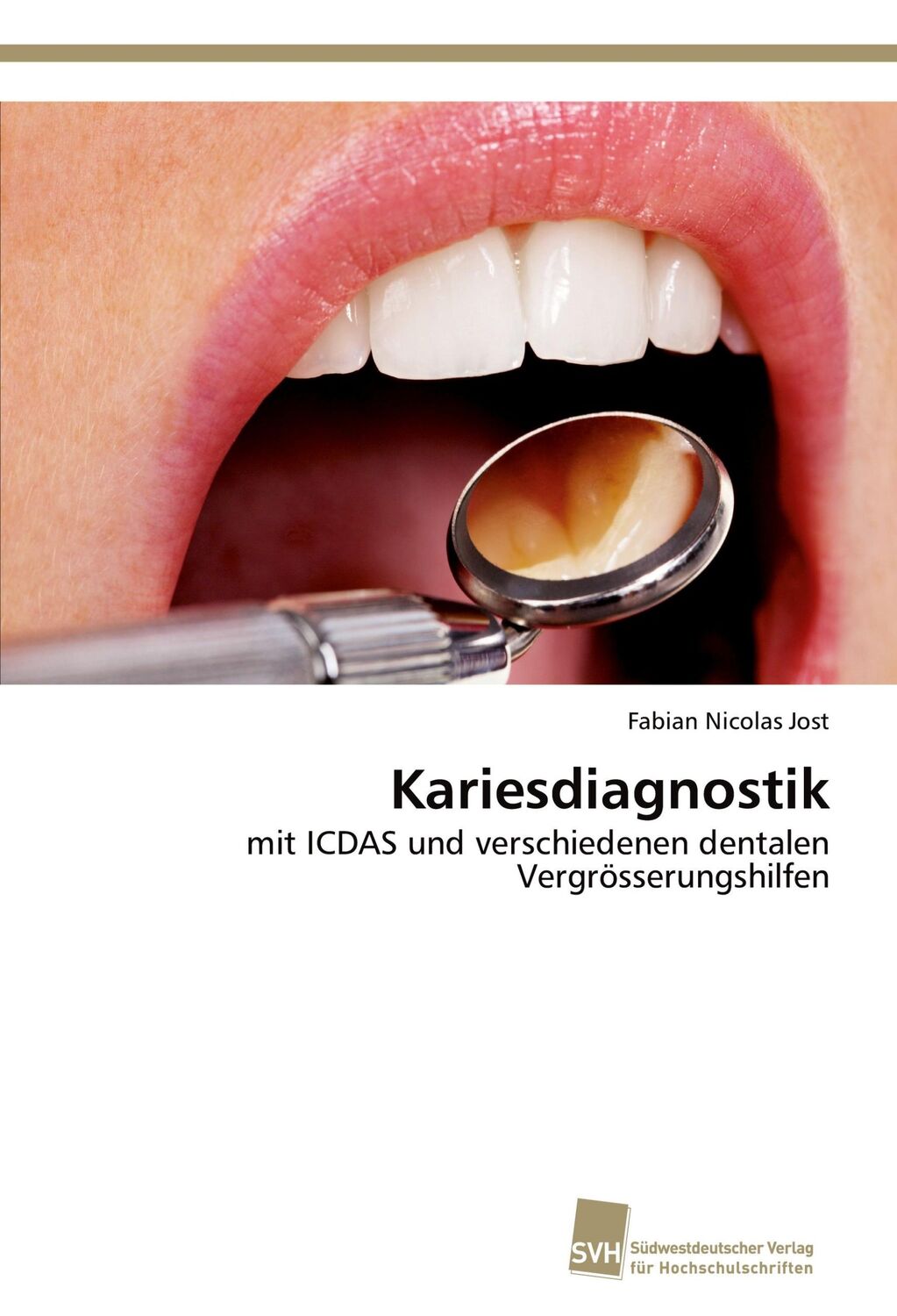 Cover: 9783838150338 | Kariesdiagnostik | Fabian Nicolas Jost | Taschenbuch | Paperback