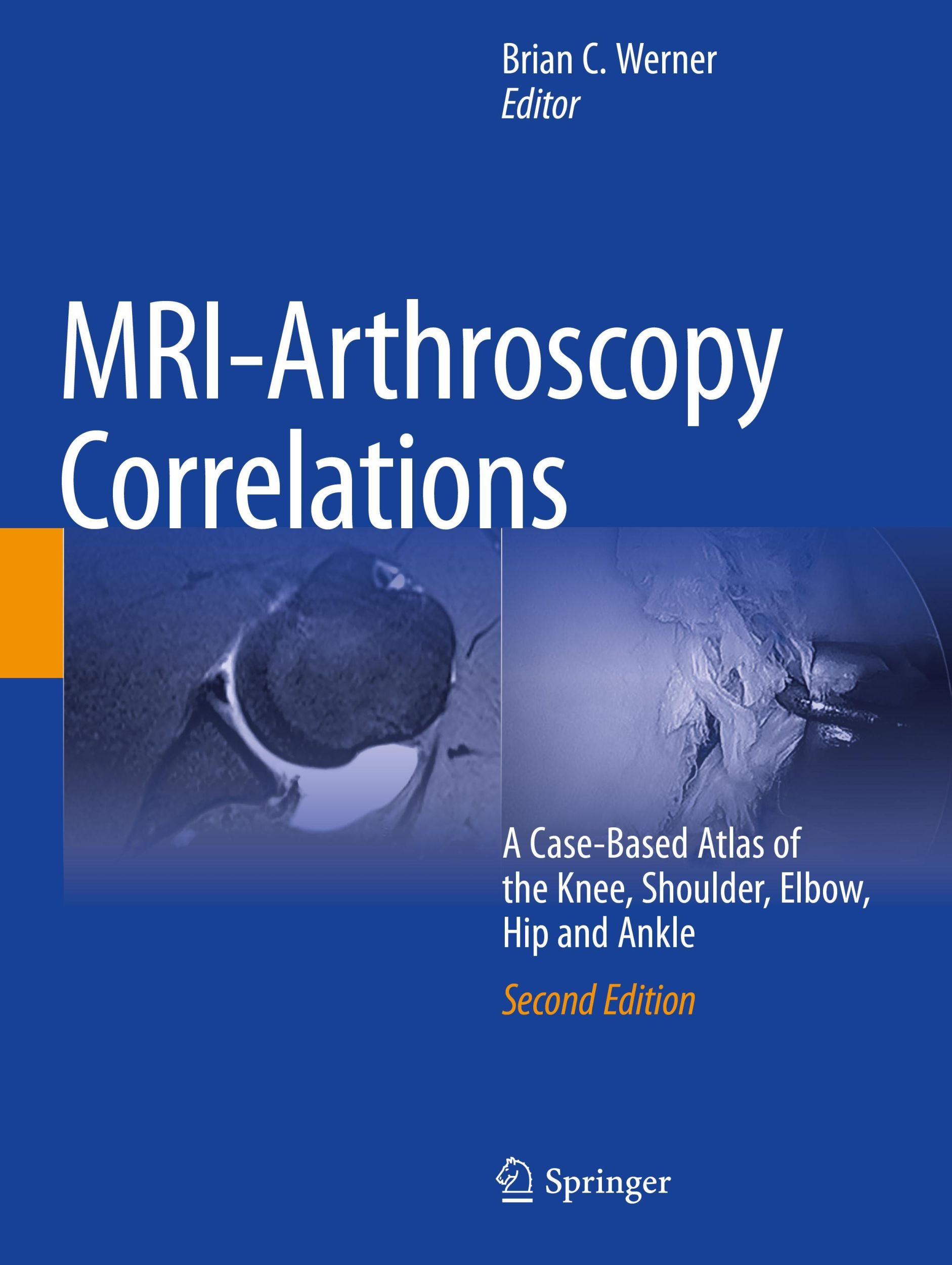 Cover: 9783030947910 | MRI-Arthroscopy Correlations | Brian C. Werner | Taschenbuch | xviii