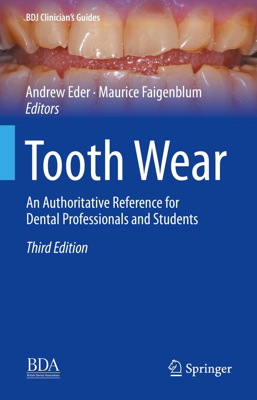 Cover: 9783030861094 | Tooth Wear | Maurice Faigenblum (u. a.) | Buch | xxii | Englisch