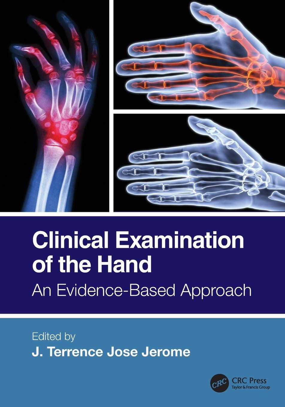 Cover: 9780367647162 | Clinical Examination of the Hand | An Evidence-Based Approach | Jerome