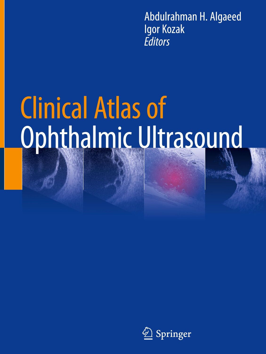 Cover: 9783319998695 | Clinical Atlas of Ophthalmic Ultrasound | Igor Kozak (u. a.) | Buch