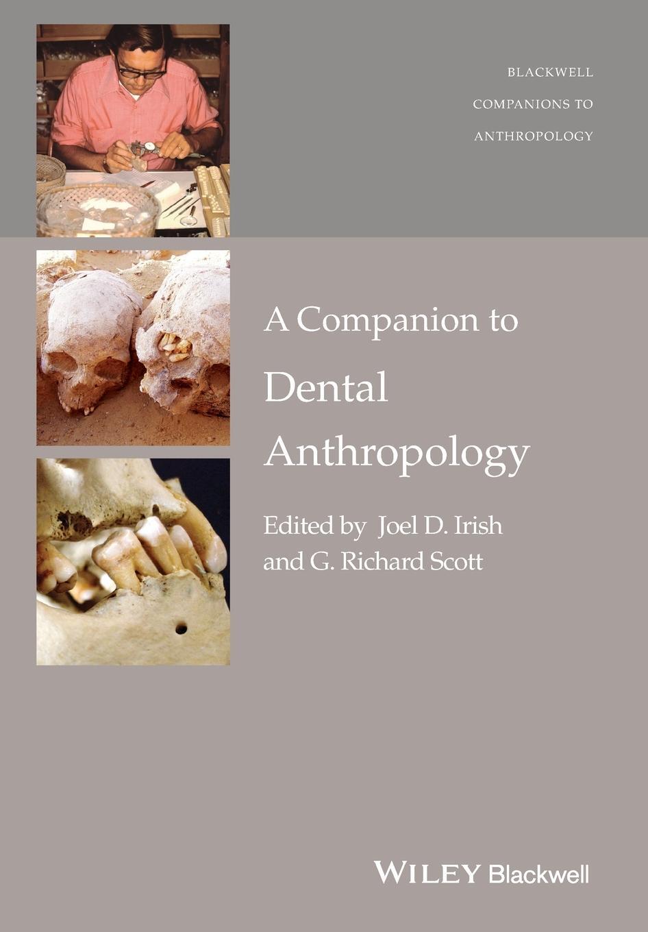 Cover: 9781119096535 | A Companion to Dental Anthropology | Joel D Irish | Taschenbuch | 2020