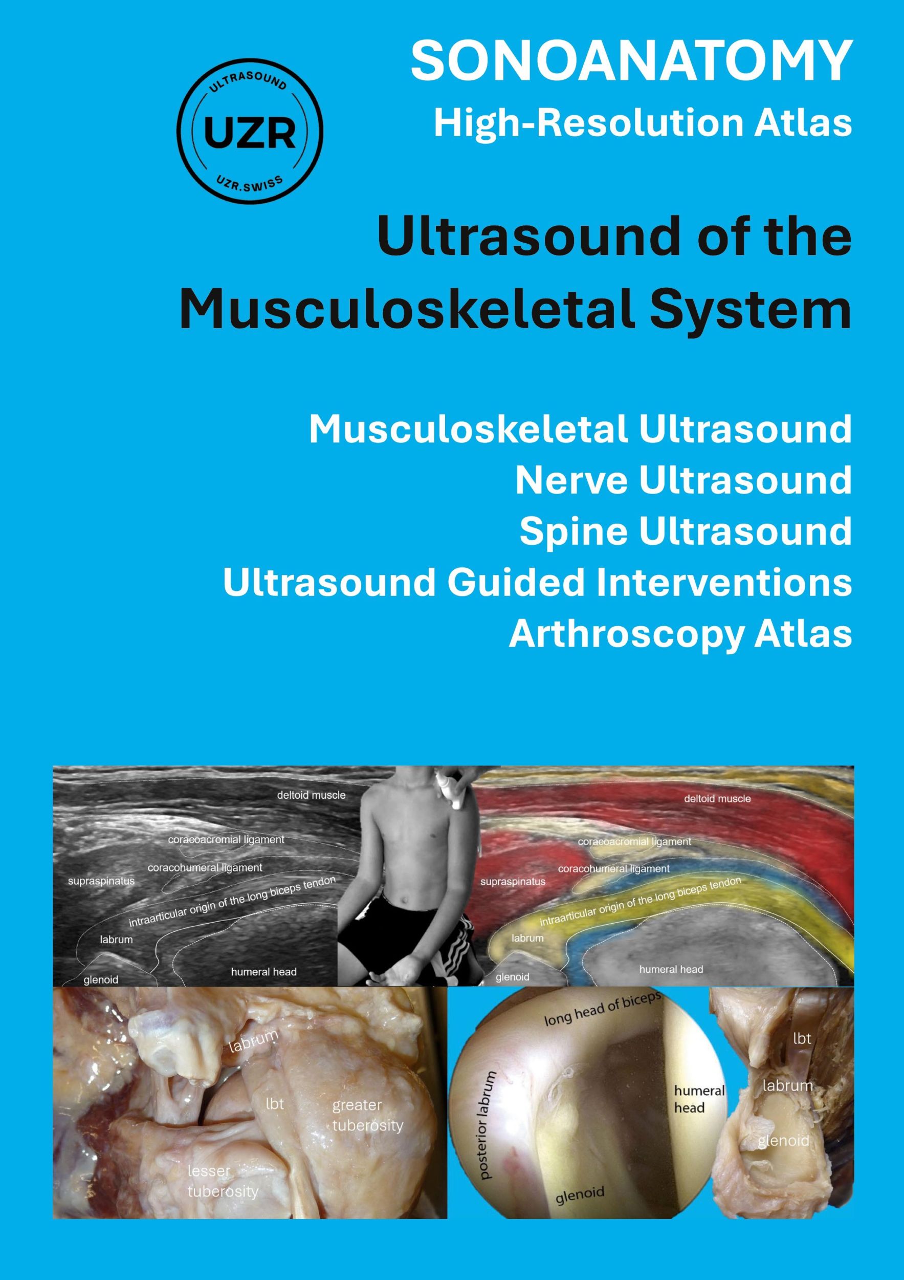 Cover: 9783769309133 | SONOANATOMY - High-Resolution Atlas - Ultrasound of the...