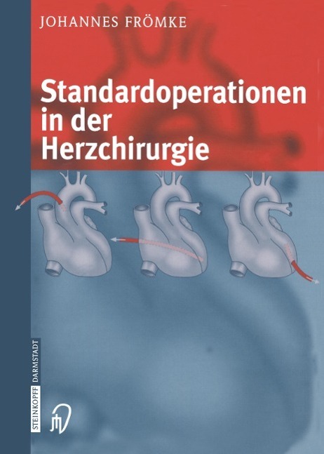 Cover: 9783642632471 | Standardoperationen in der Herzchirurgie | Johannes Frömke | Buch | x