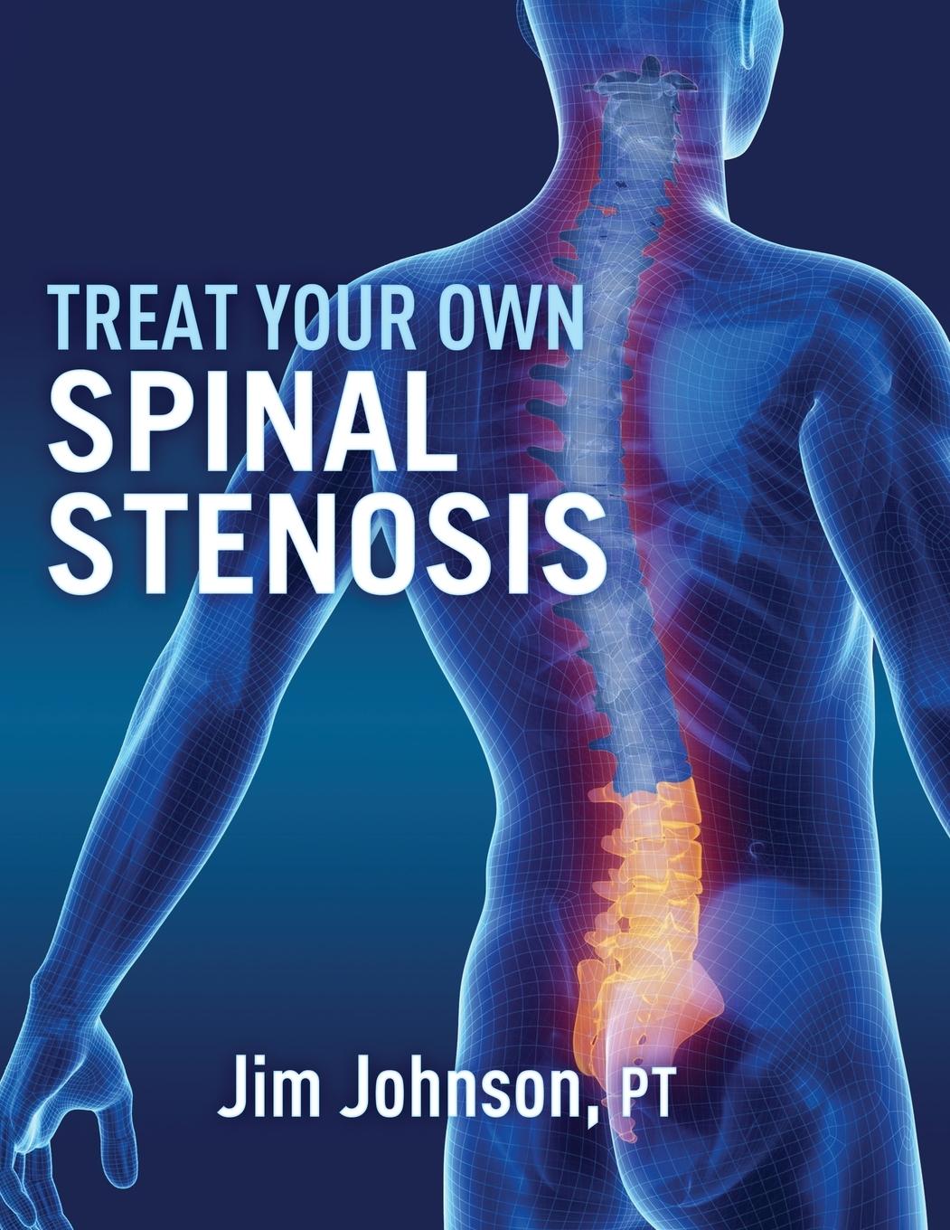 Cover: 9781642379587 | Treat Your Own Spinal Stenosis | Jim Johnson | Taschenbuch | Englisch