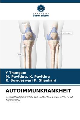 Cover: 9786205896266 | AUTOIMMUNKRANKHEIT | Y. Thangam (u. a.) | Taschenbuch | Paperback