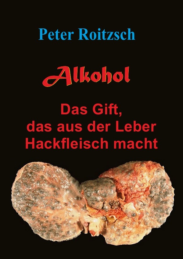 Cover: 9783748503149 | Alkohol - Das Gift, das aus der Leber Hackfleisch macht | Roitzsch