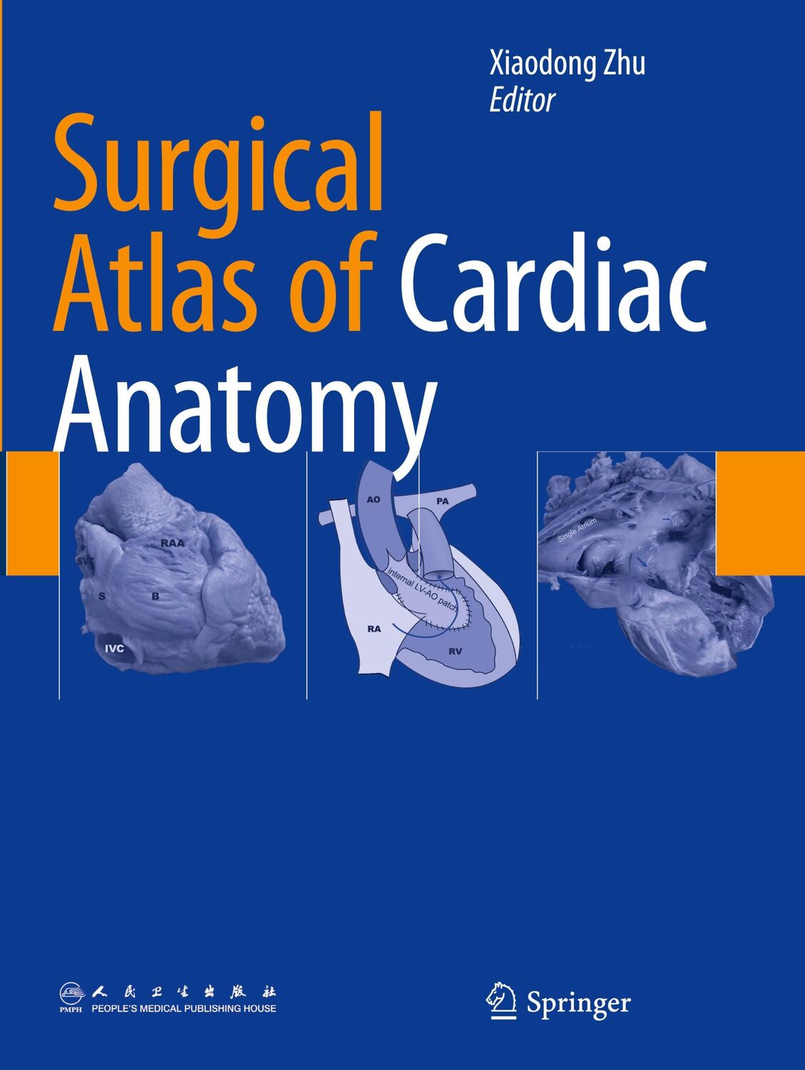 Cover: 9789402402407 | Surgical Atlas of Cardiac Anatomy | Xiaodong Zhu | Taschenbuch | xxii