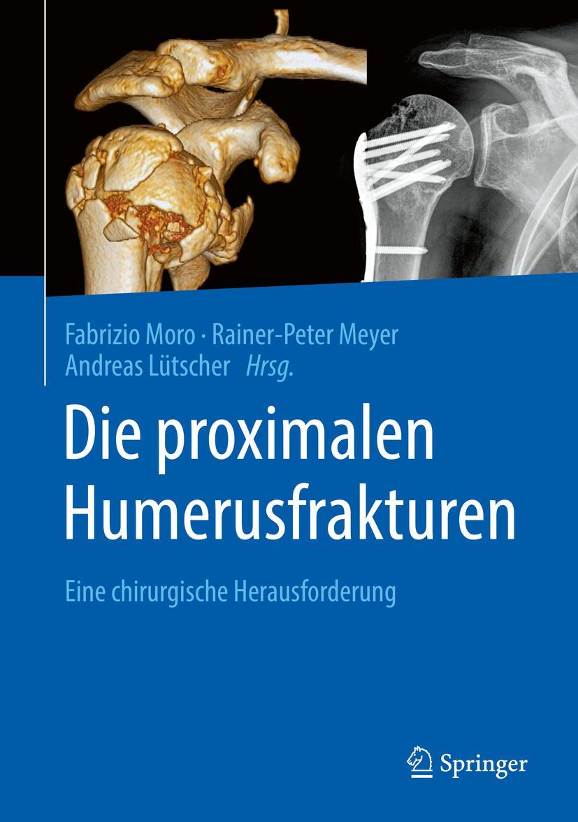 Cover: 9783662608524 | Die proximalen Humerusfrakturen | Eine chirurgische Herausforderung