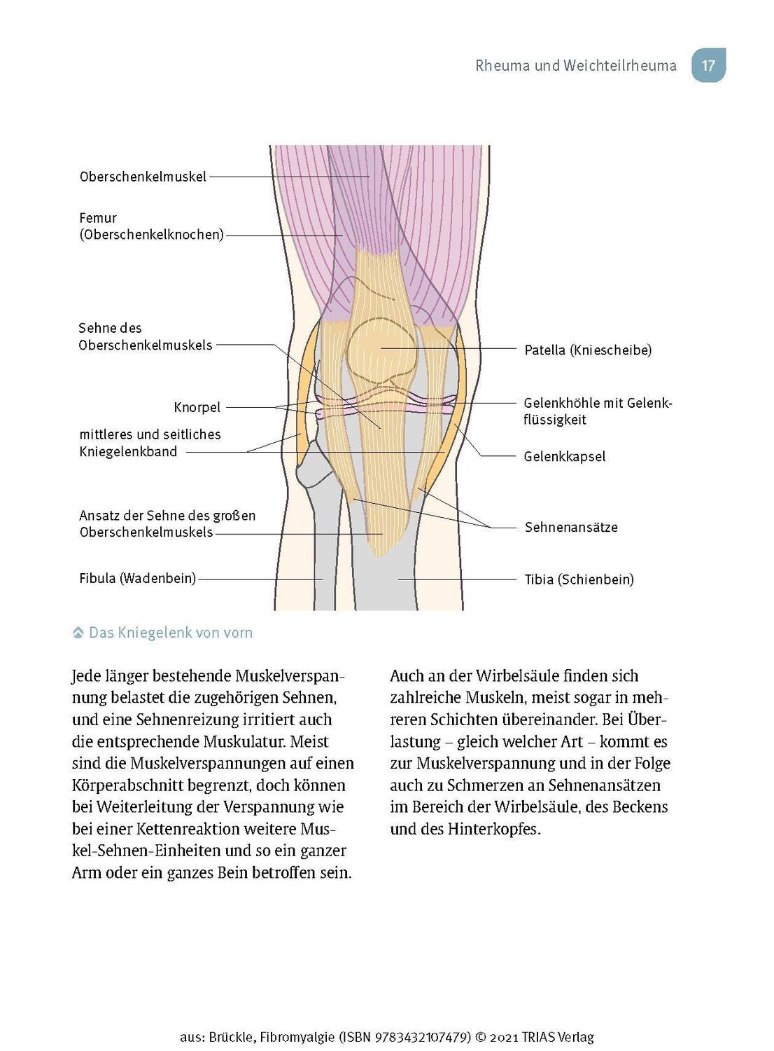 Bild: 9783432117355 | Fibromyalgie | Endlich erkennen - richtig behandeln | Wolfgang Brückle