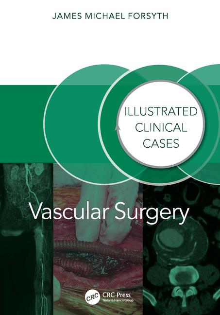 Cover: 9781032804811 | Vascular Surgery | Illustrated Clinical Cases | James Forsyth | Buch