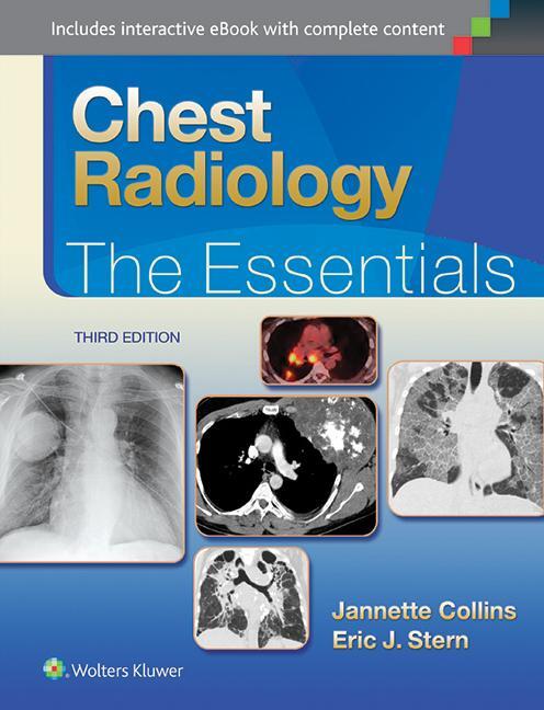 Cover: 9781451144482 | Chest Radiology: The Essentials | Eric J. Stern (u. a.) | Buch | 2014