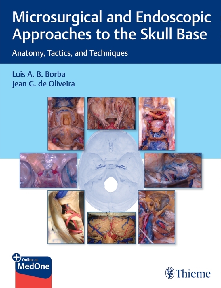 Cover: 9781626239661 | Microsurgical and Endoscopic Approaches to the Skull Base | Bundle