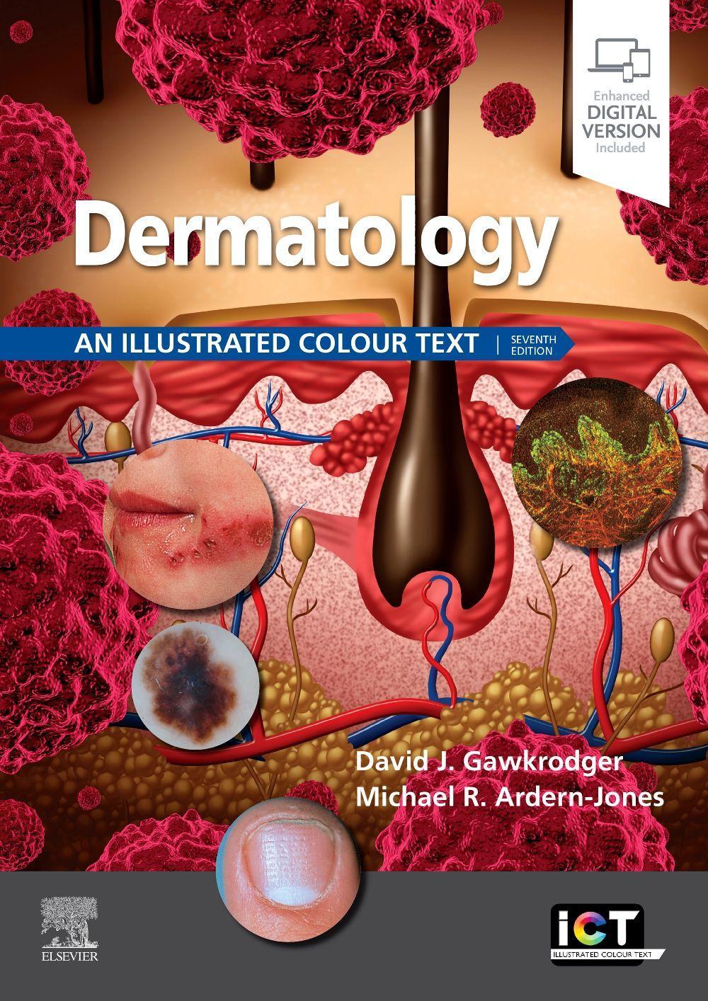 Cover: 9780702079962 | Dermatology | An Illustrated Colour Text | David Gawkrodger (u. a.)