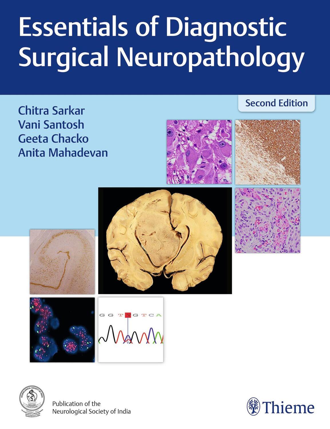 Cover: 9789395390057 | Essentials of Diagnostic Surgical Neuropathology | Sarkar (u. a.)