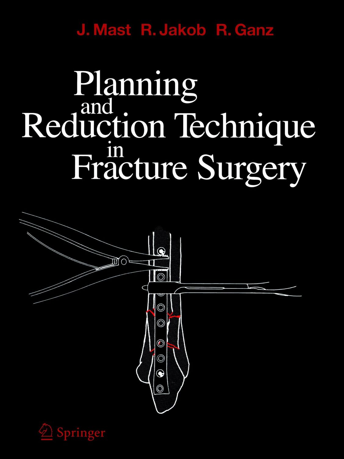 Cover: 9783540162834 | Planning and Reduction Technique in Fracture Surgery | Mast (u. a.)