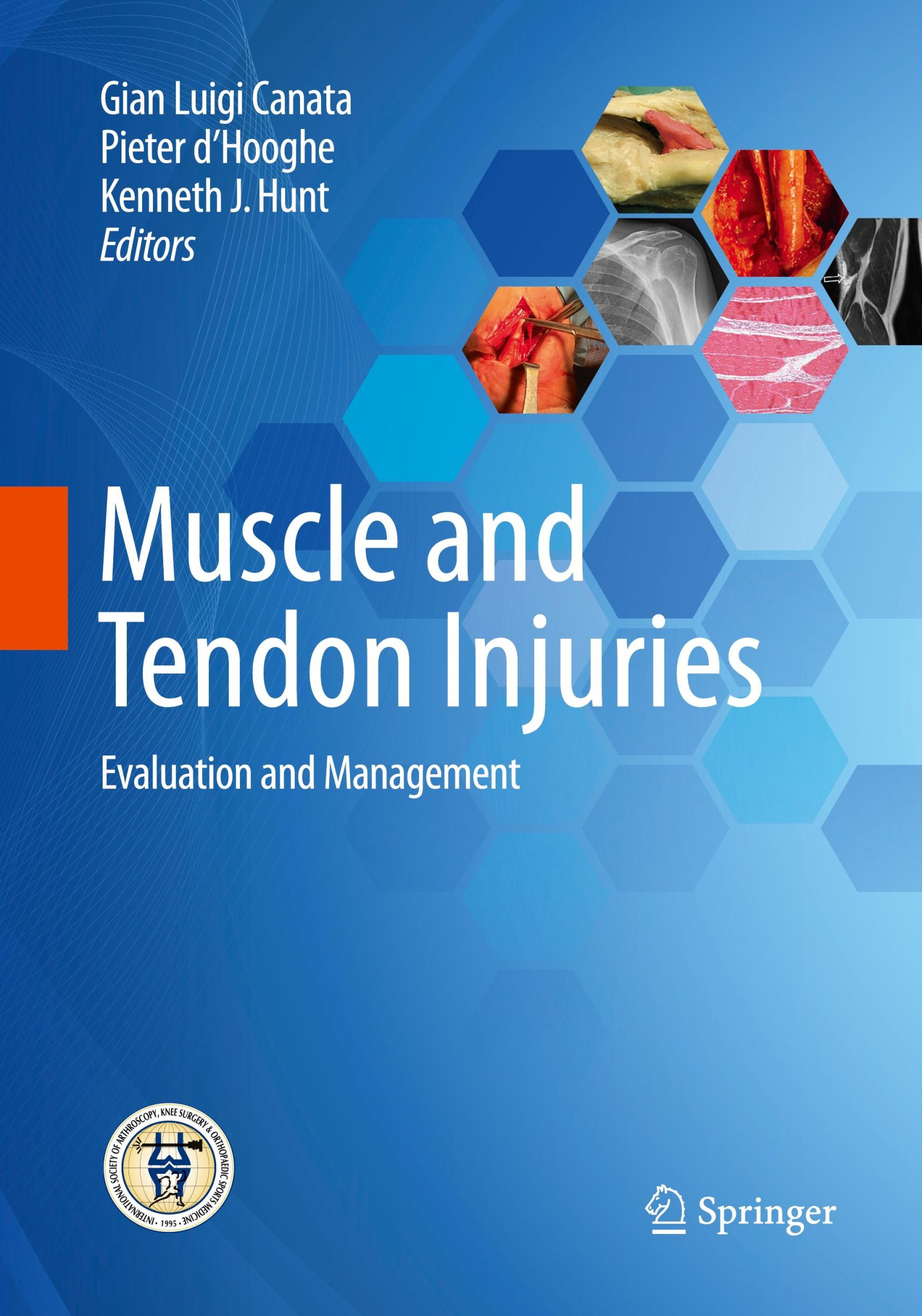 Cover: 9783662571859 | Muscle and Tendon Injuries | Evaluation and Management | Taschenbuch